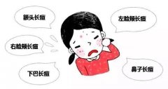 缔美诗课堂：护肤课堂之护理闭口粉刺